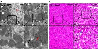 Vanadium Induces Oxidative Stress and Mitochondrial Quality Control Disorder in the Heart of Ducks